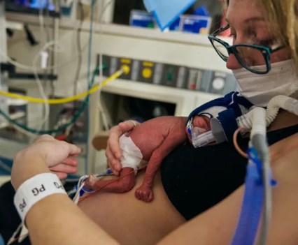 Person with a premature infant on their chest in a hospital setting. The baby is wearing a diaper, and has tubes and a ventilator