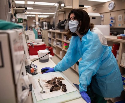 Heerema-McKenney, a placenta pathologist, works in the lab. She noticed the impact COVID-19 was having on placentas and stillbirths.